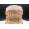 深圳义齿工厂 义齿的制作、设计、加工、义齿材料的批发